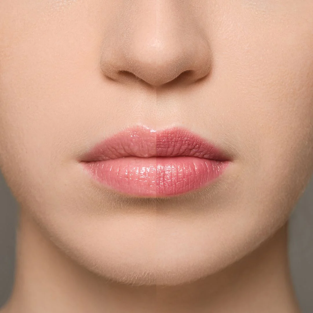 Supreme Lip Treatment – Fraise - Image 2